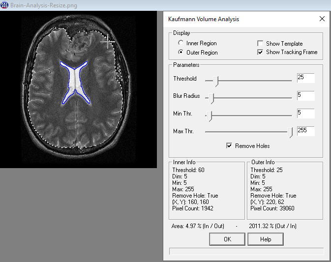 Brain Analysis Function - After Brain Analysis Function - After